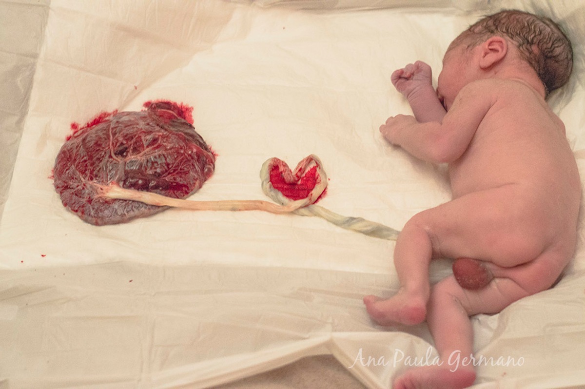 Recém-nascido ainda ligado ao cordão umbilical e placenta, após Parto Humanizado em Casa Angela - Centro de Parto Humanizado, Zona Sul, São Paulo/SP