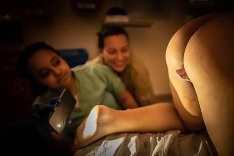 parto normal pelvico'