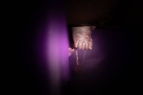 parto pelvico normal'