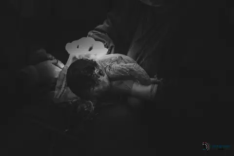 Fotografia de parto, parto no santa joana, parto do pro matre, parto do são luiz, parto cesária, foto de parto, nascimento foto, fotografia de parto, fotografia de nascimento'