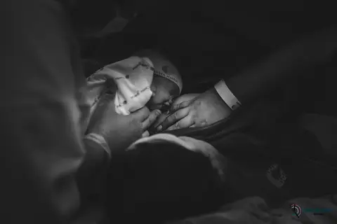 Fotografia de parto, parto no santa joana, parto do pro matre, parto do são luiz, parto cesária, foto de parto, nascimento foto, fotografia de parto, fotografia de nascimento'