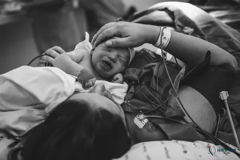 Fotografia de parto, parto no santa joana, parto do pro matre, parto do são luiz, parto cesária, foto de parto, nascimento foto, fotografia de parto, fotografia de nascimento'