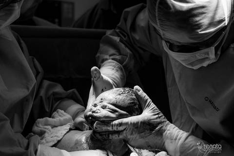 foto de parto em salvador'