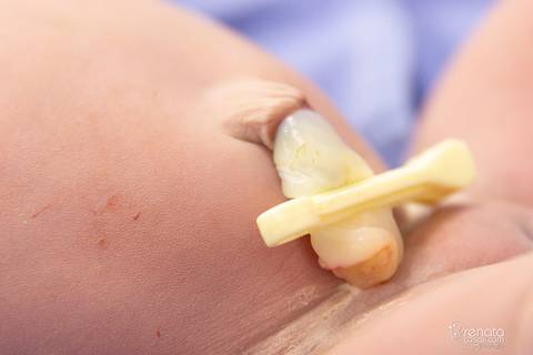 fotografia de parto salvador maternidade santamaria'