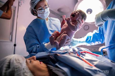 fotografia de parto salvador maternidade santamaria'