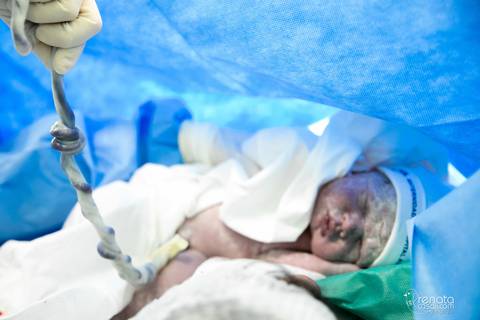 fotografia de parto em salvador'