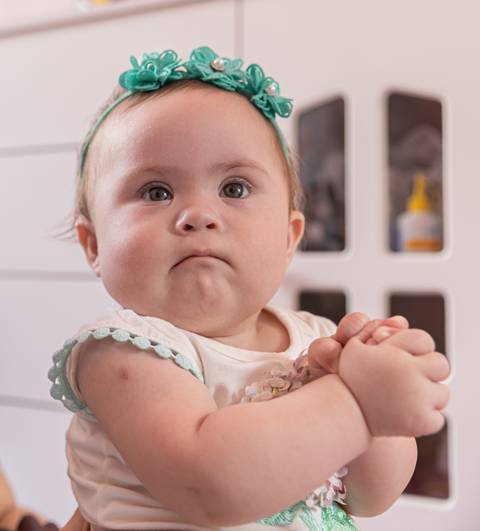 criança com síndrome de down'