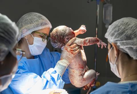 recém nascido na mesa de parto'