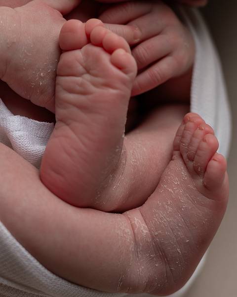 Ensaio Newborn em Estúdio em Natal'