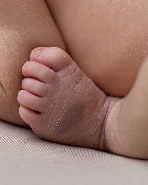 ensaio newborn em natal rn'