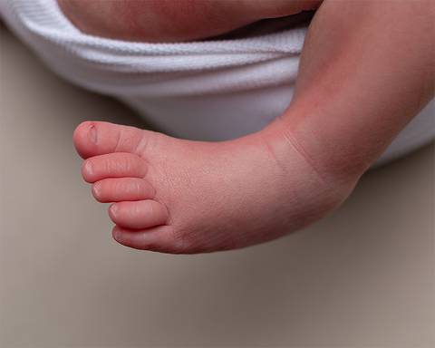 ensaio newborn em natal rn'