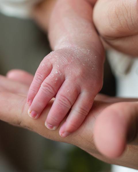 ensaio newborn em natal rn'