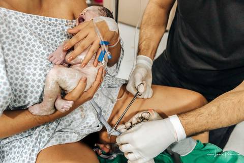 fotografia de parto - hospital rio grande - maternidade delfin - natal rn - parto cesaria - fotografo de parto - familia - nascimento - fotografo em natal - fotografo de familia - parto normal - medico - obstetra - parto natural - promater - unimed - mae'