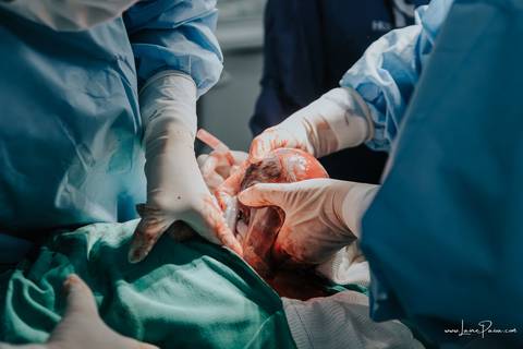 fotografia de parto - hospital rio grande - maternidade delfin - natal rn - parto cesaria - fotografo de parto - familia - nascimento - fotografo em natal - fotografo de familia - parto normal - medico - obstetra - parto natural - promater - unimed - mae'