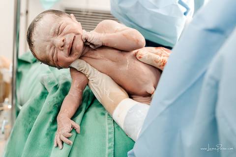 fotografia de parto - hospital rio grande - maternidade delfin - natal rn - parto cesaria - fotografo de parto - familia - nascimento - fotografo em natal - fotografo de familia - parto normal - medico - obstetra - parto natural - promater - unimed - mae'