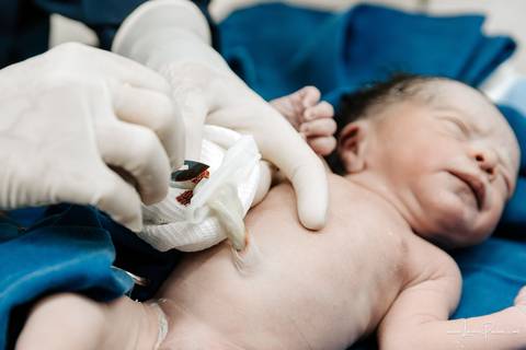 fotografia de parto - hospital rio grande - maternidade delfin - natal rn - parto cesaria - fotografo de parto - familia - nascimento - fotografo em natal - fotografo de familia - parto normal - medico - obstetra - parto natural - promater - unimed - mae'