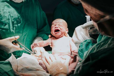 fotografia de parto - hospital rio grande - maternidade delfin - natal rn - parto cesaria - fotografo de parto - familia - nascimento - fotografo em natal - fotografo de familia - parto normal - medico - obstetra - parto natural - promater - unimed - mae'