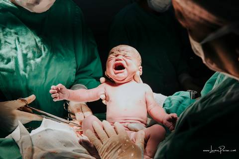 fotografia de parto - hospital rio grande - maternidade delfin - natal rn - parto cesaria - fotografo de parto - familia - nascimento - fotografo em natal - fotografo de familia - parto normal - medico - obstetra - parto natural - promater - unimed - mae'