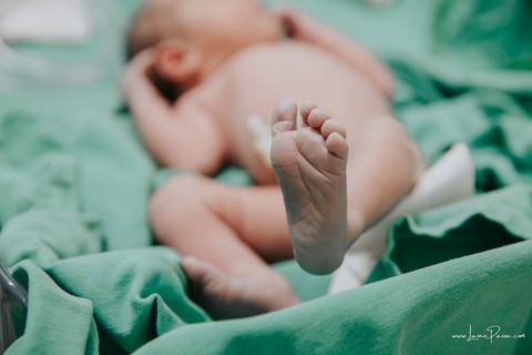 fotografia de parto - hospital rio grande - maternidade delfin - natal rn - parto cesaria - fotografo de parto - familia - nascimento - fotografo em natal - fotografo de familia - parto normal - medico - obstetra - parto natural - promater - unimed - mae'