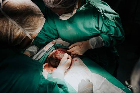 fotografia de parto - hospital rio grande - maternidade delfin - natal rn - parto cesaria - fotografo de parto - familia - nascimento - fotografo em natal - fotografo de familia - parto normal - medico - obstetra - parto natural - promater - unimed - mae'