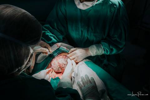 fotografia de parto - hospital rio grande - maternidade delfin - natal rn - parto cesaria - fotografo de parto - familia - nascimento - fotografo em natal - fotografo de familia - parto normal - medico - obstetra - parto natural - promater - unimed - mae'