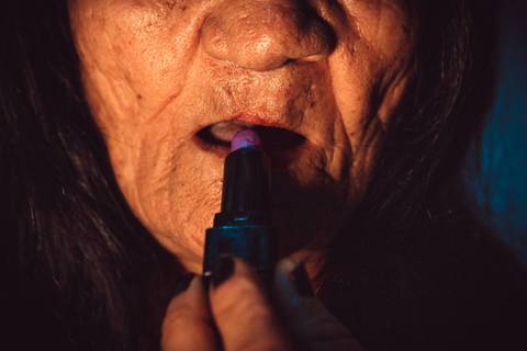 Operacao Sorriso, Labio leporino, exposição fotografia, fotografia documental, idosa, fissura labiopalatina, fissura labial, ensaio documental, Natal, operation smile'