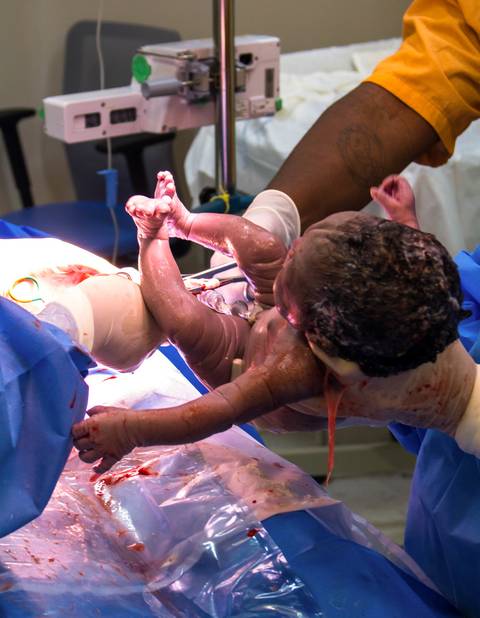 Francielle e seu parceiro no hospital são luiz do anália franco, na capital de são paulo. parto de yanna. médicas em parto humanizado cesariano. Yanna nascendo. pai cortando cordão umbilical.'
