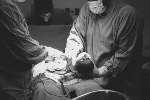 fotografia documental de parto , fotos de cesaria, parto em campo grande, nascimento de bebe, hospital SATA CASA'