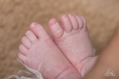 detalhe dos pés do recém nascido newborn cheio de casquinha newborn brasilia'