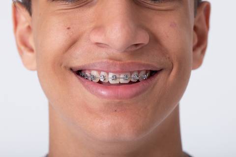 dentista odontologia a melhor do lago sul smdb setor de mansões dom bosco jardim botanico brasilia df fotografia corporativa ortodontia pacientes'