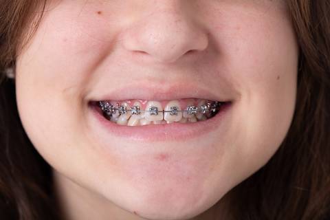 dentista odontologia a melhor do lago sul smdb setor de mansões dom bosco jardim botanico brasilia df fotografia corporativa ortodontia pacientes'