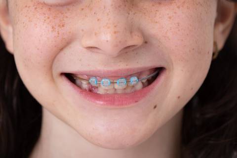 dentista odontologia a melhor do lago sul smdb setor de mansões dom bosco jardim botanico brasilia df fotografia corporativa ortodontia pacientes'