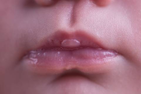 newborn brasilia df amarelo com rosa recem nascido recém nascido baby bebê pequeno novo nascimento dormindo pose mão no queixo bracinho pose do bumbum manta rosa toca soneca listrada branca com rosa segurando coração wrap enrolado pano macro boca detalhe'