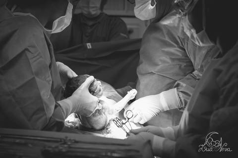 nascido maternidade santa helena parto fotografa fotografo fotógrafa brasília DF gestante sala de parto fotografia registrado pela fotografa Letícia Franco hospital anestesia nascendo cesárea'