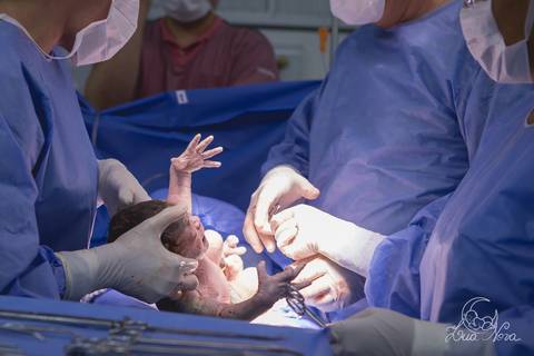 nascido maternidade santa helena parto fotografa fotografo fotógrafa brasília DF gestante sala de parto fotografia registrado pela fotografa Letícia Franco hospital anestesia nascendo cabeça cesárea '