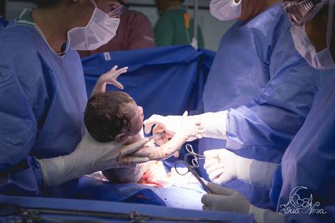 nascido maternidade santa helena parto fotografa fotografo fotógrafa brasília DF gestante sala de parto fotografia registrado pela fotografa Letícia Franco hospital anestesia nascendo cabeça cesárea '