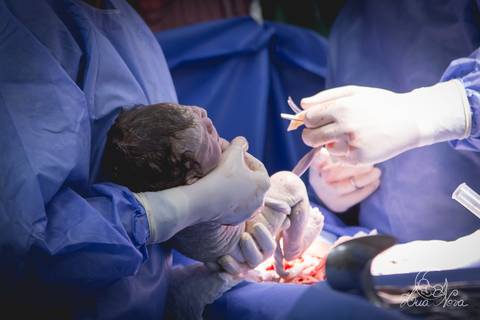 nascido maternidade santa helena parto fotografa fotografo fotógrafa brasília DF gestante sala de parto fotografia registrado pela fotografa Letícia Franco hospital anestesia nascendo cabeça cesárea '