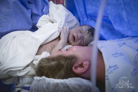 nascido maternidade santa helena parto fotografa fotografo fotógrafa brasília DF gestante sala de parto fotografia registrado pela fotografa Letícia Franco hospital anestesia nascendo cabeça cesárea com a mamãe'