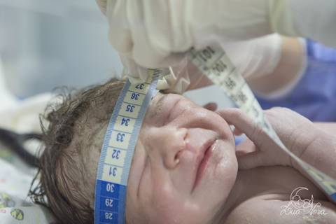 nascido maternidade santa helena parto fotografa fotografo fotógrafa brasília DF gestante sala de parto fotografia registrado pela fotografa Letícia Franco hospital primeiros cuidados apgar medindo cabeça'