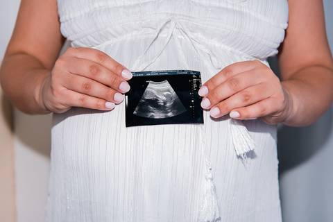 Foto da Mãe Segurando a Foto do Último Ultrassom Em Frente à Barriga em Itaquera - SP, Foto Feita Pela Priscila Felix Fotógrafa de Família, Casamento e Ensaios '
