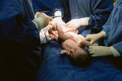 fotografia de parto, fotografia de nascimento, parto em pouso alegre, fotografa de parto, fotografia pouso alegre, fotografa pouso alegre , gestante pouso alegre'