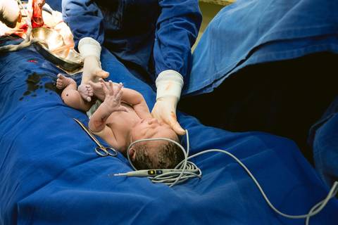 fotografia de parto, fotografia de nascimento, parto em pouso alegre, fotografa de parto, fotografia pouso alegre, fotografa pouso alegre , gestante pouso alegre'