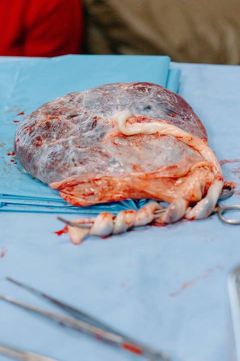 fotografa maternidade albert einstein sp'