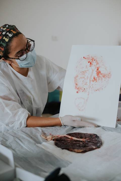 parto domiciliar guarujá
'