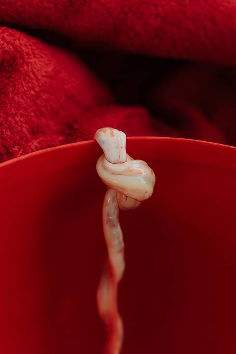 foto de cordão umbilical'