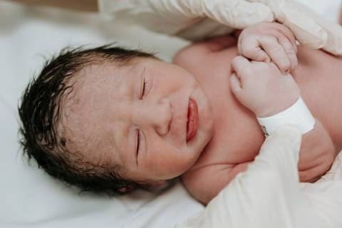 Foto aproximada do rosto do segundo gêmeo logo após o parto.'