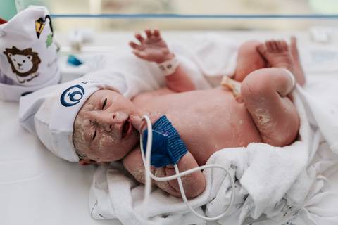 Foto do bebê Guilherme deitado logo após o nascimento.'