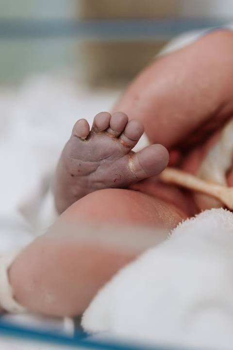 Foto em detalhe do pezinho do Guilherme com vernix.'