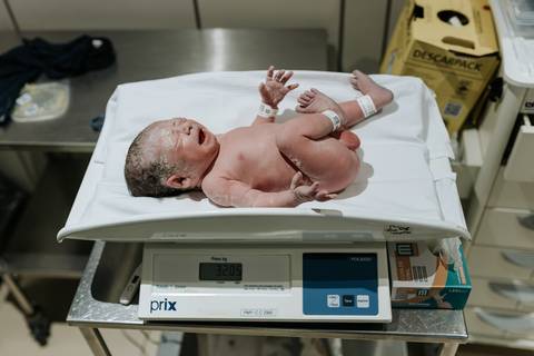 Foto do bebê sendo pesado na balança pediátrica.'