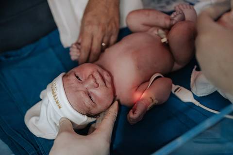 Foto do bebê Davi deitadinho recebendo os primeiros cuidados da equipe médica.'